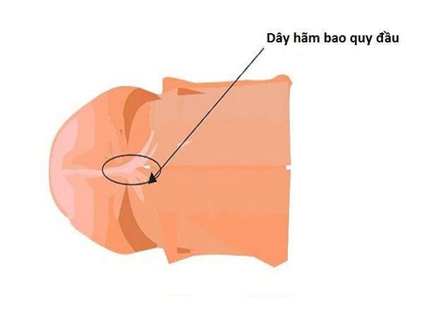 Dây hãm bao quy đầu