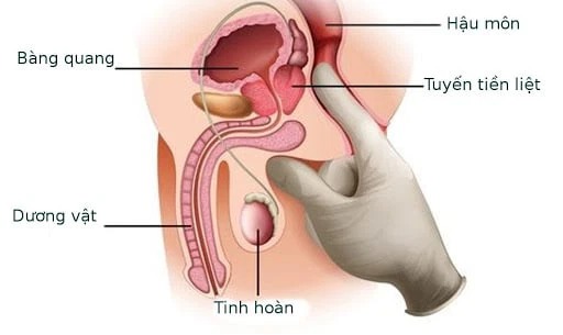Tuyến tiền liệt - Điểm G chính